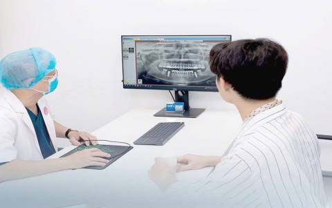 Trồng răng Implant tại Vindental Đà Lạt: Giải pháp hoàn hảo cho hàm răng khỏe đẹp