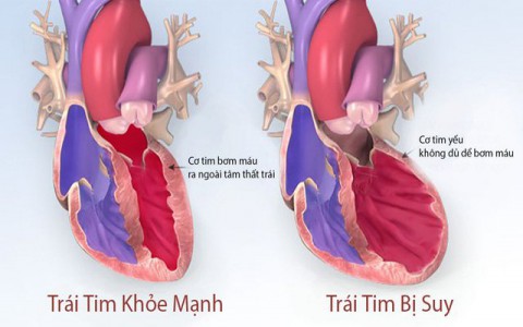 Dược thiện hỗ trợ điều trị suy tim mạn tính