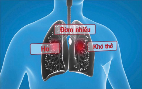 Một số phương thuốc hay chữa đàm nhiệt khái thấu