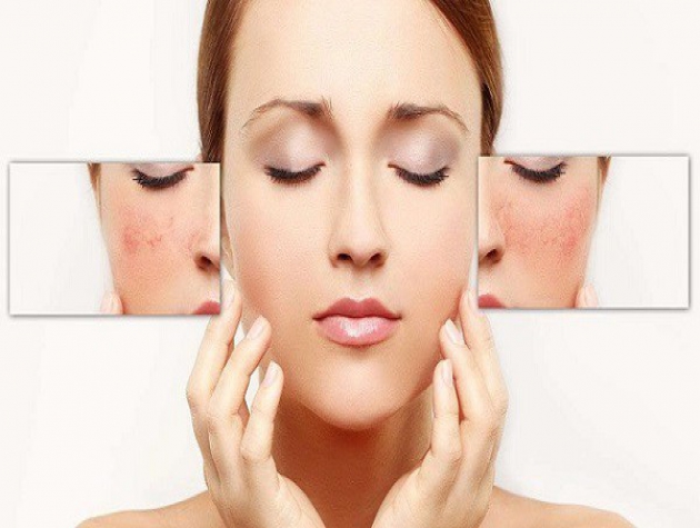 Mẹo trị nám da bằng nguyên liệu thiên nhiên